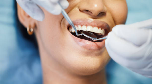 Best Broken or Chipped Tooth Repair in Columbia, KY